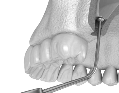 Implantology Course 2