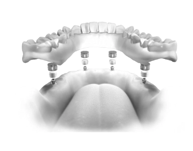 Implantology Course 3