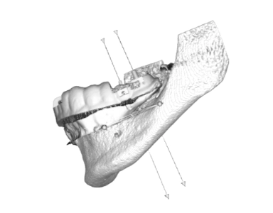 Implantology Course 4