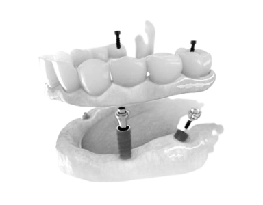 Implantology Course 5